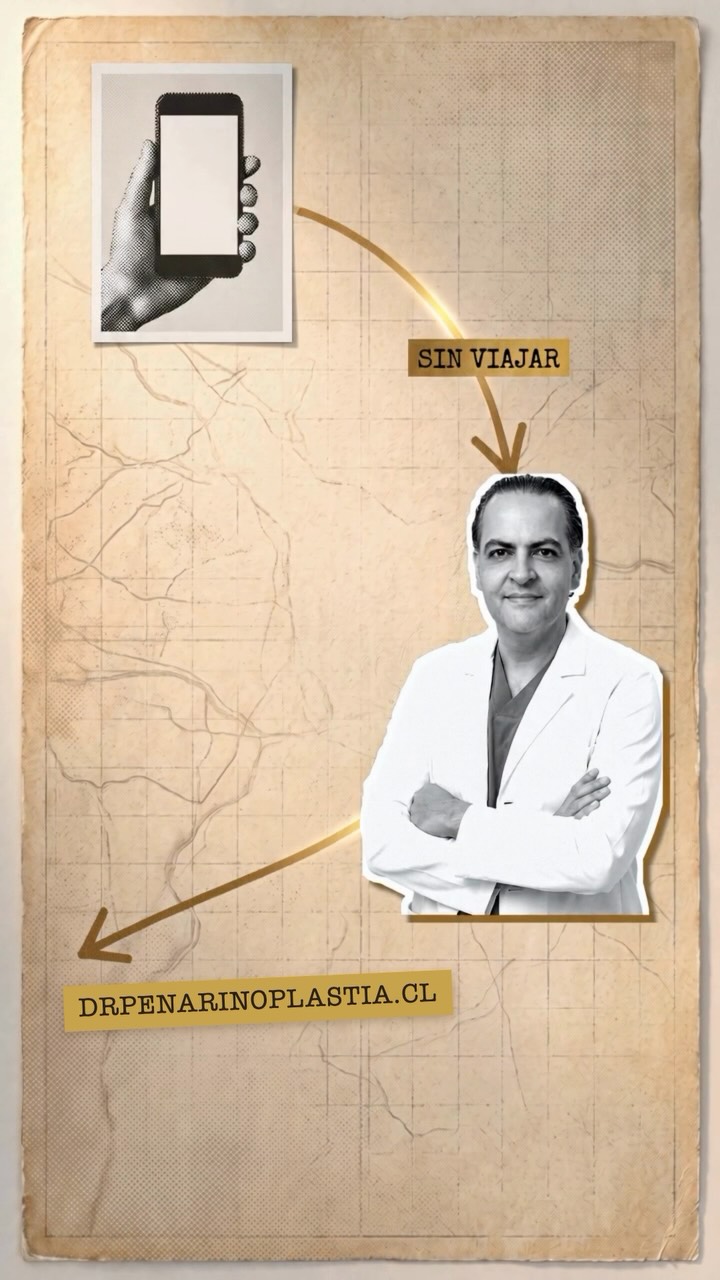 El Dr. Peña explica la septoplastía en un video de Instagram